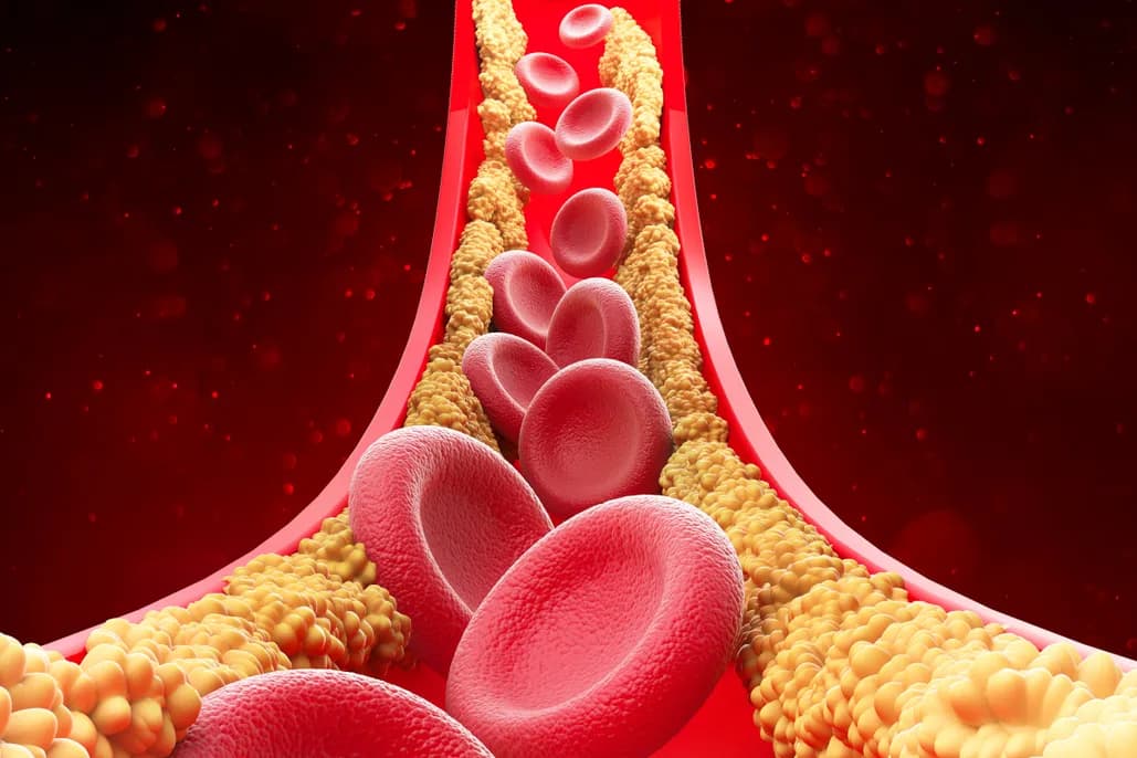 Cholesterol & Lipid Profile