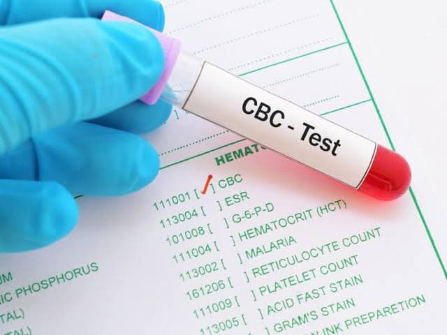 Complete Blood Count CBC